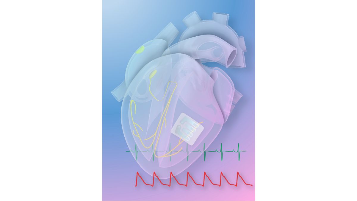 Graphene ‘Tattoo’ Treats Cardiac Arrhythmia With Light