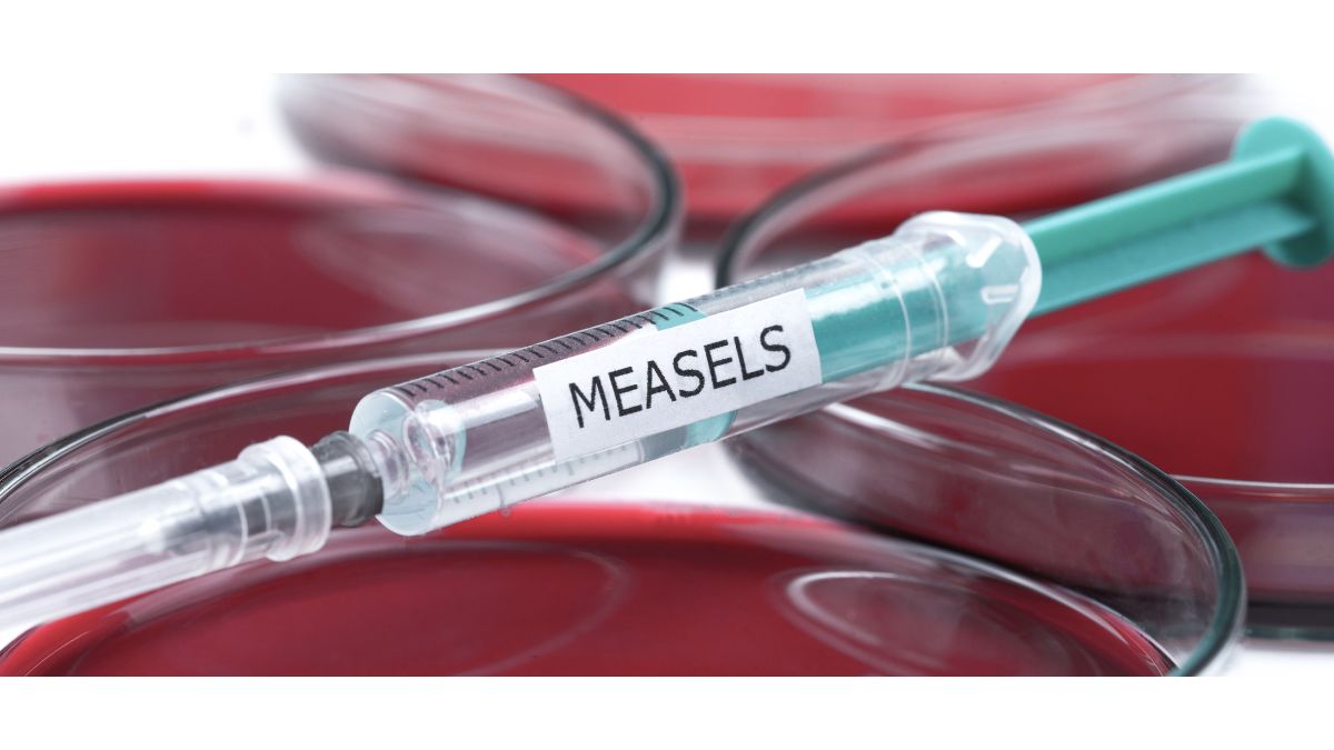 IDPH Declares Measles Outbreak in Northeast Illinois is Over with No New Cases Since Mid-April