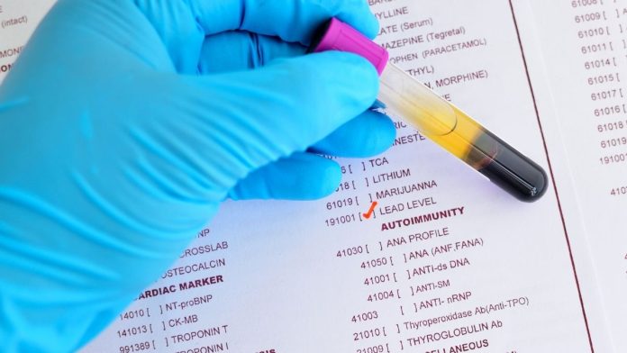 IDPH Marks Childhood Lead Poisoning Prevention Week